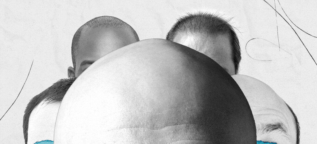 ‘Welcome to the sexy zone’: How to go bald gracefully